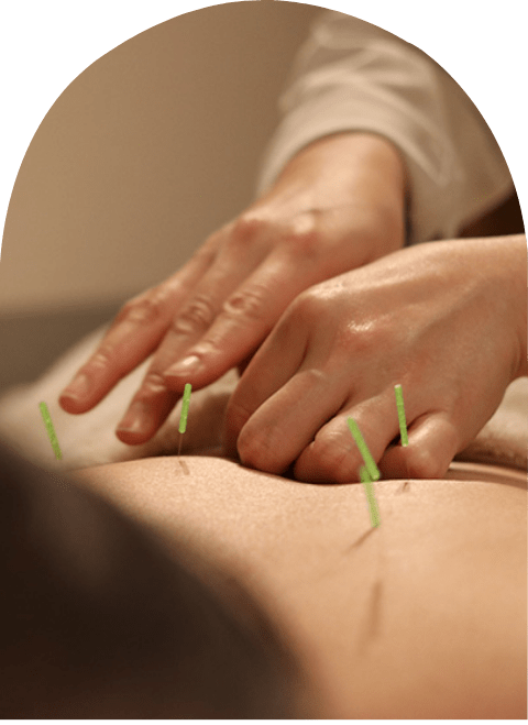 鍼灸